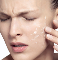 What causes our skin to be sensitive?