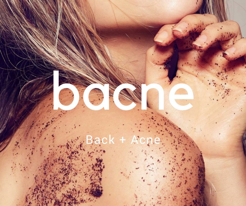 All about Bacne and why is it plaguing us?